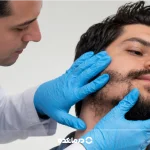 کاشت ریش و سبیل [۴ روش، عوارض، دوره نقاهت + بهترین سن]